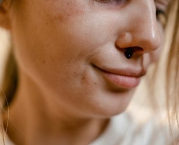 Pajączki na skrzydełkach nosa? Skuteczne sposoby, by je wyciszyć i rozjaśnić cerę
